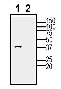 Anti-GPRC5A Antibody