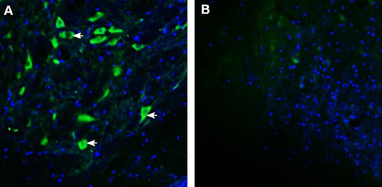 Anti-GPRC5B Antibody