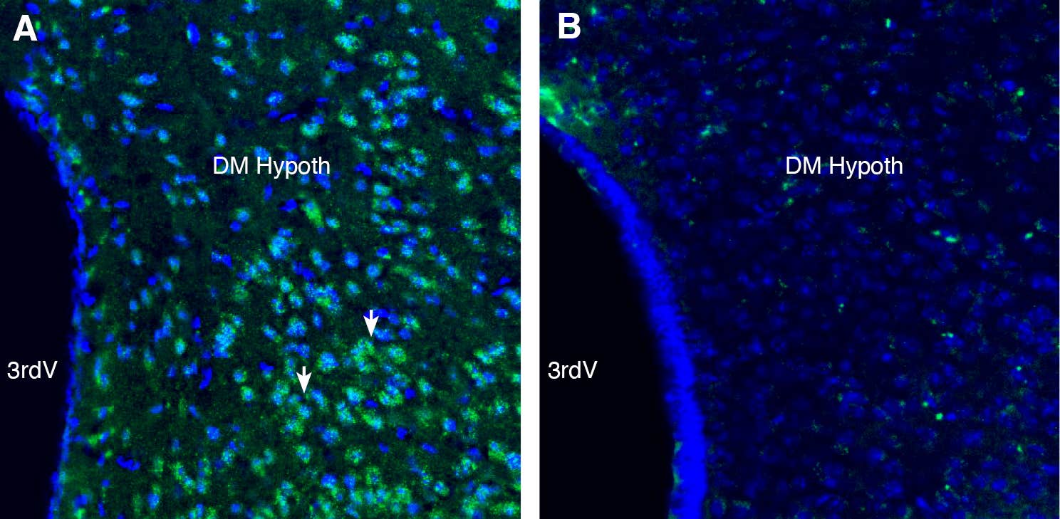 Anti-GPR75 Antibody