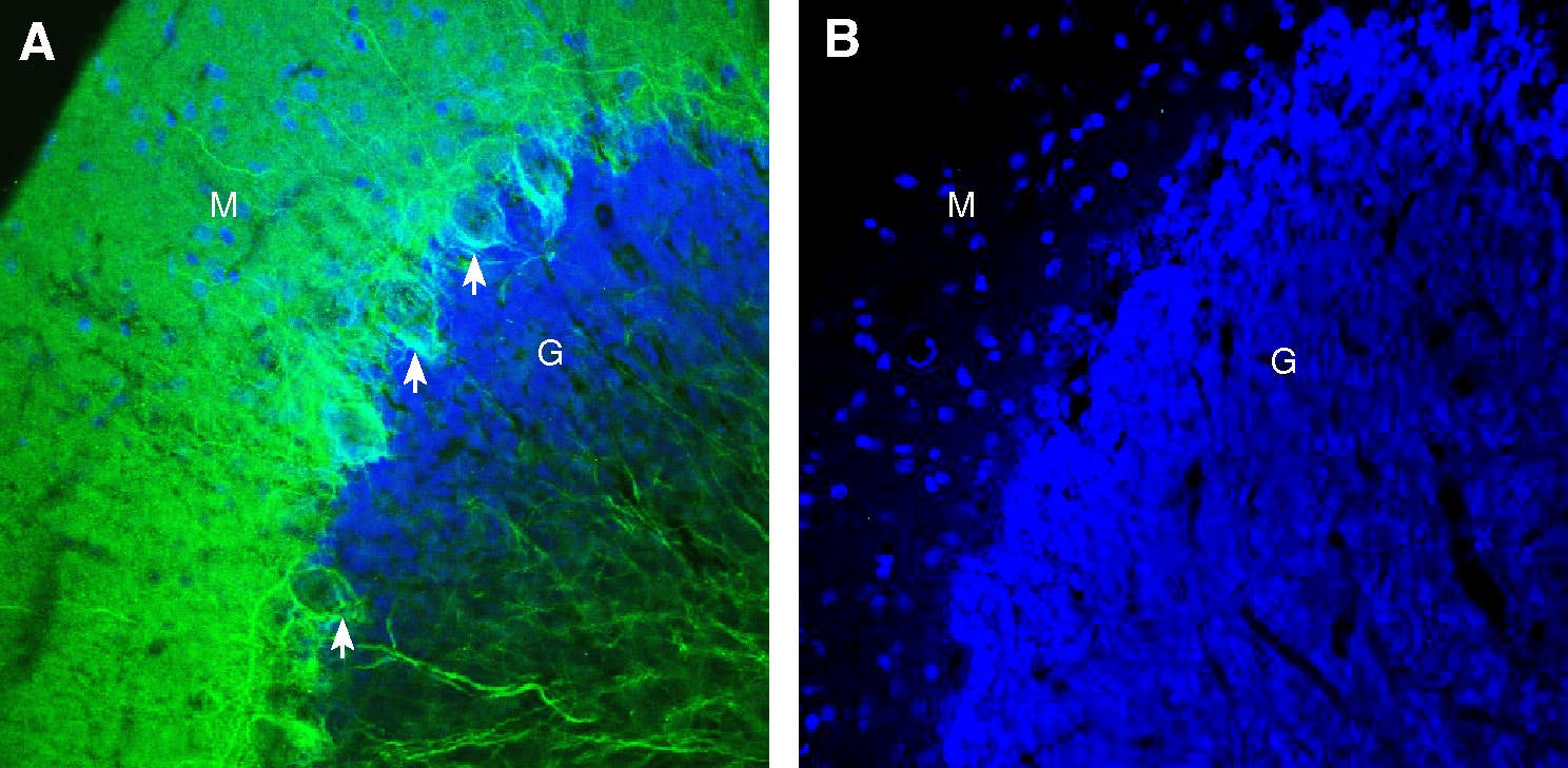 Anti-GPR158 Antibody