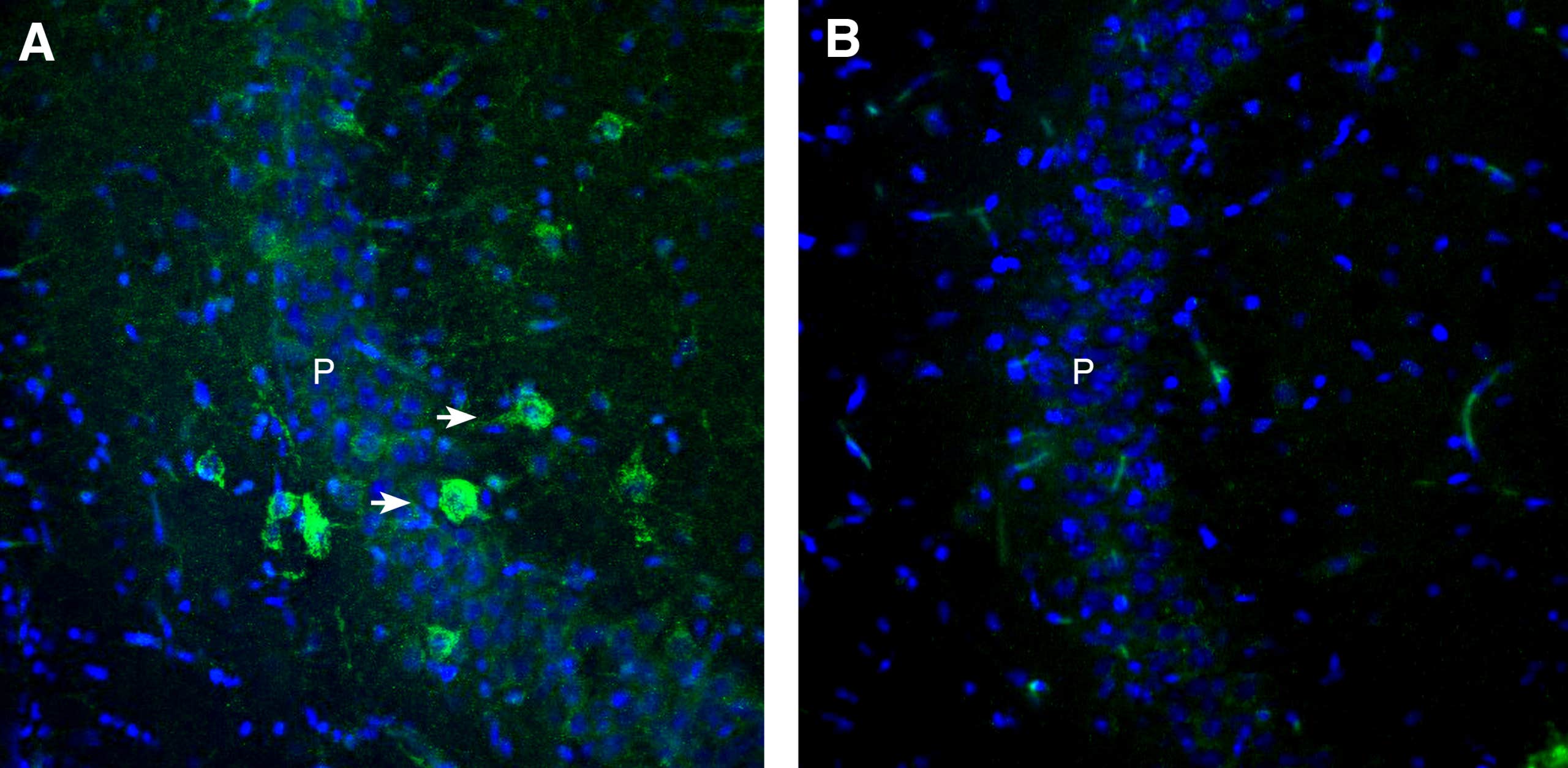 Anti-GPR151 (extracellular) Antibody