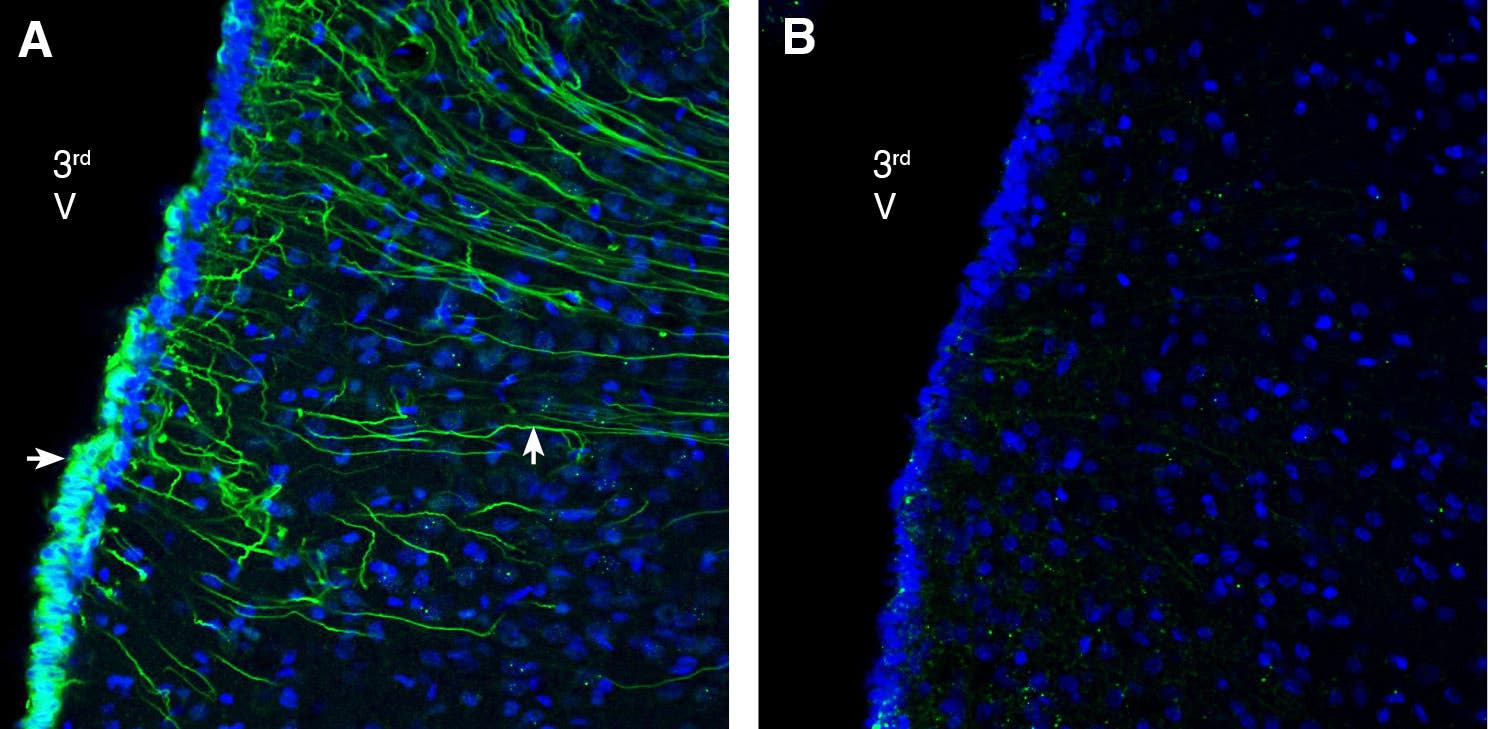 Anti-GPR142 (extracellular) Antibody