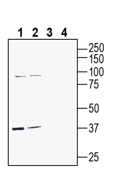 GPR142 (extracellular) Blocking Peptide