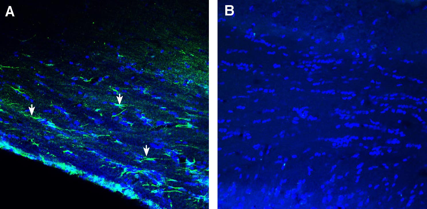 Anti-GPR143 Antibody