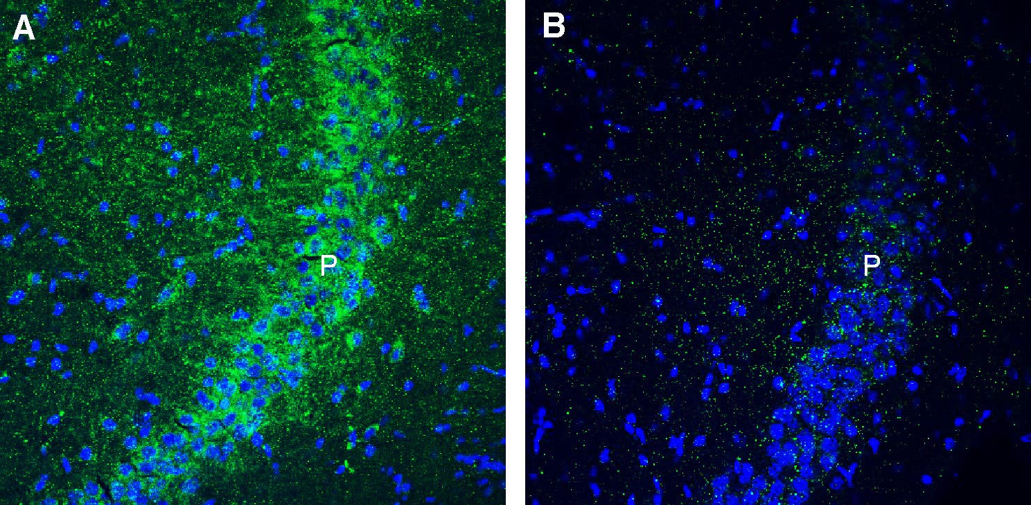 Anti-GPR160 Antibody