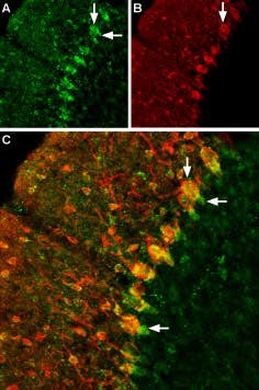 Anti-GABA Transporter 1 (GAT-1) (extracellular) Antibody
