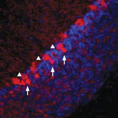Anti-Vesicular GABA Transporter (VGAT) Antibody