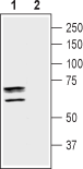 Anti-Taurine Transporter (SLC6A6) Antibody