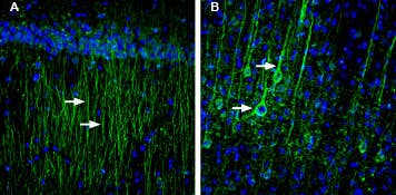 Anti-SLC6A8 Antibody