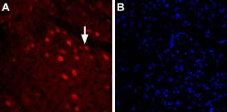 Anti-GlyT2 (SLC6A5) (extracellular) Antibody