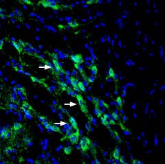 Anti-SLC6A14 (extracellular) Antibody