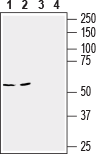SLC6A14 (extracellular) Blocking Peptide