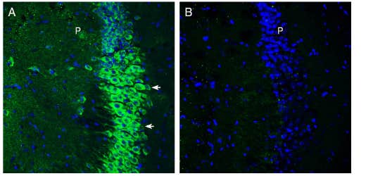 Anti-SLC6A15 Antibody