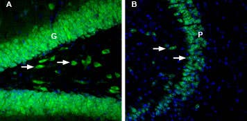 Anti-GLUT2 (SLC2A2)-ATTO Fluor-488 Antibody
