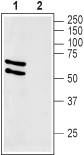 GLUT2/SLC2A2 Blocking Peptide