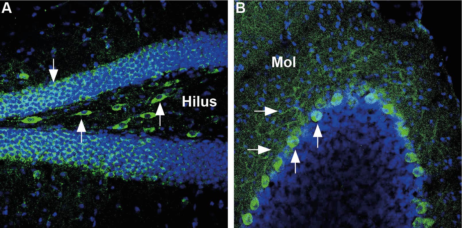Anti-GLUT3 (extracellular) Antibody
