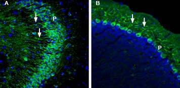 Anti-GLUT5 (SLC2A5) Antibody