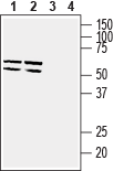 GLUT5/SLC2A5 Blocking Peptide