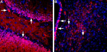 Anti-SGLT1 (extracellular) Antibody