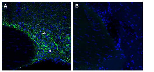 Anti-SMCT1 (SLC5A8) Antibody