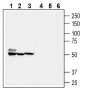 SMCT1 (SLC5A8) Blocking Peptide
