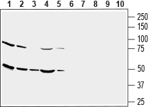 Anti-Human GLUT3 (extracellular) Antibody