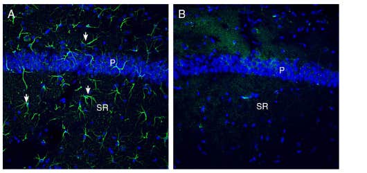 Anti-OTOP1 Antibody