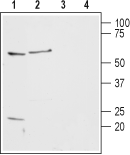 Histamine H2 Receptor/HRH2 (extracellular) Blocking Peptide