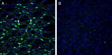 Anti-Histamine H<sub>1 </sub> Receptor/HRH1 (extracellular) Antibody
