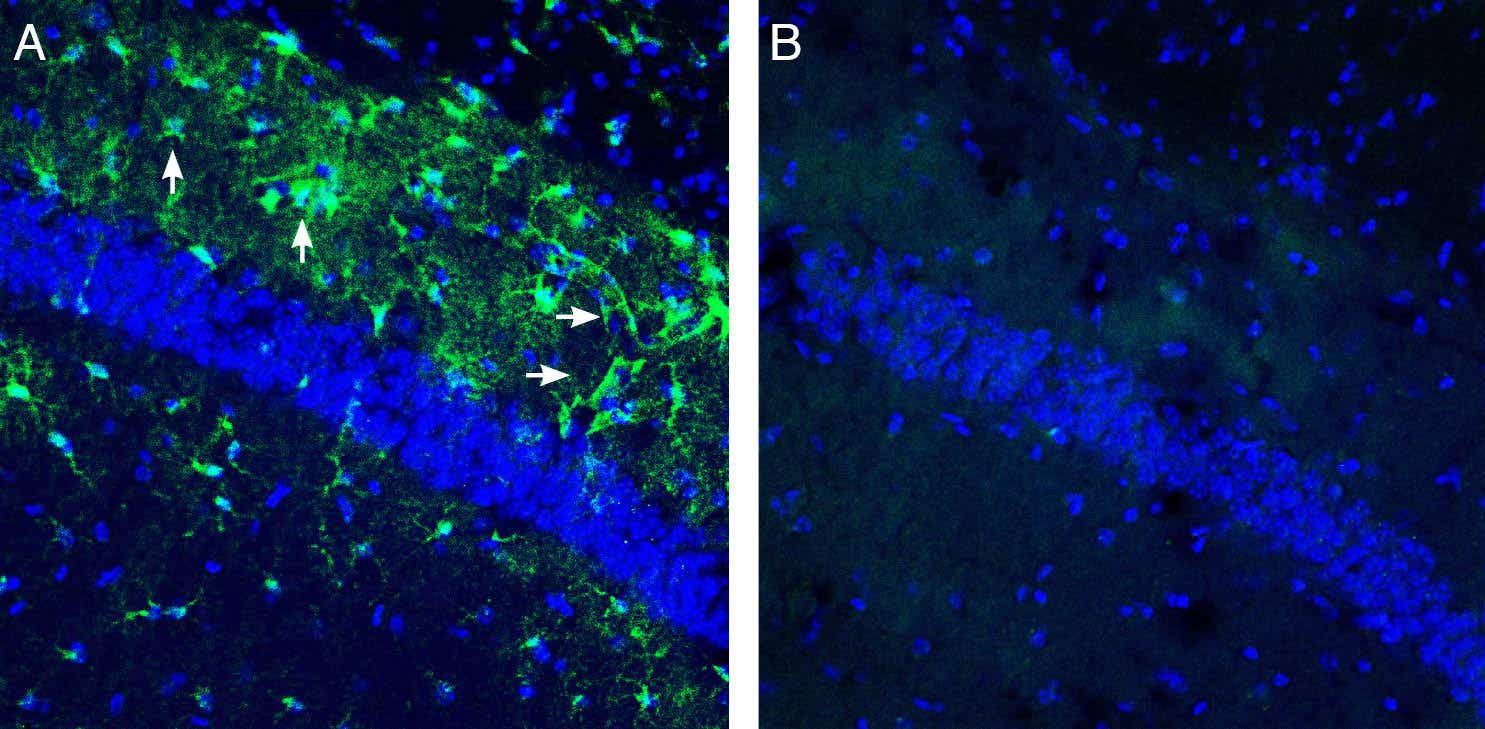 Anti-GPR81/HCAR1 Antibody