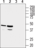 GPR81/HCAR1 Blocking Peptide