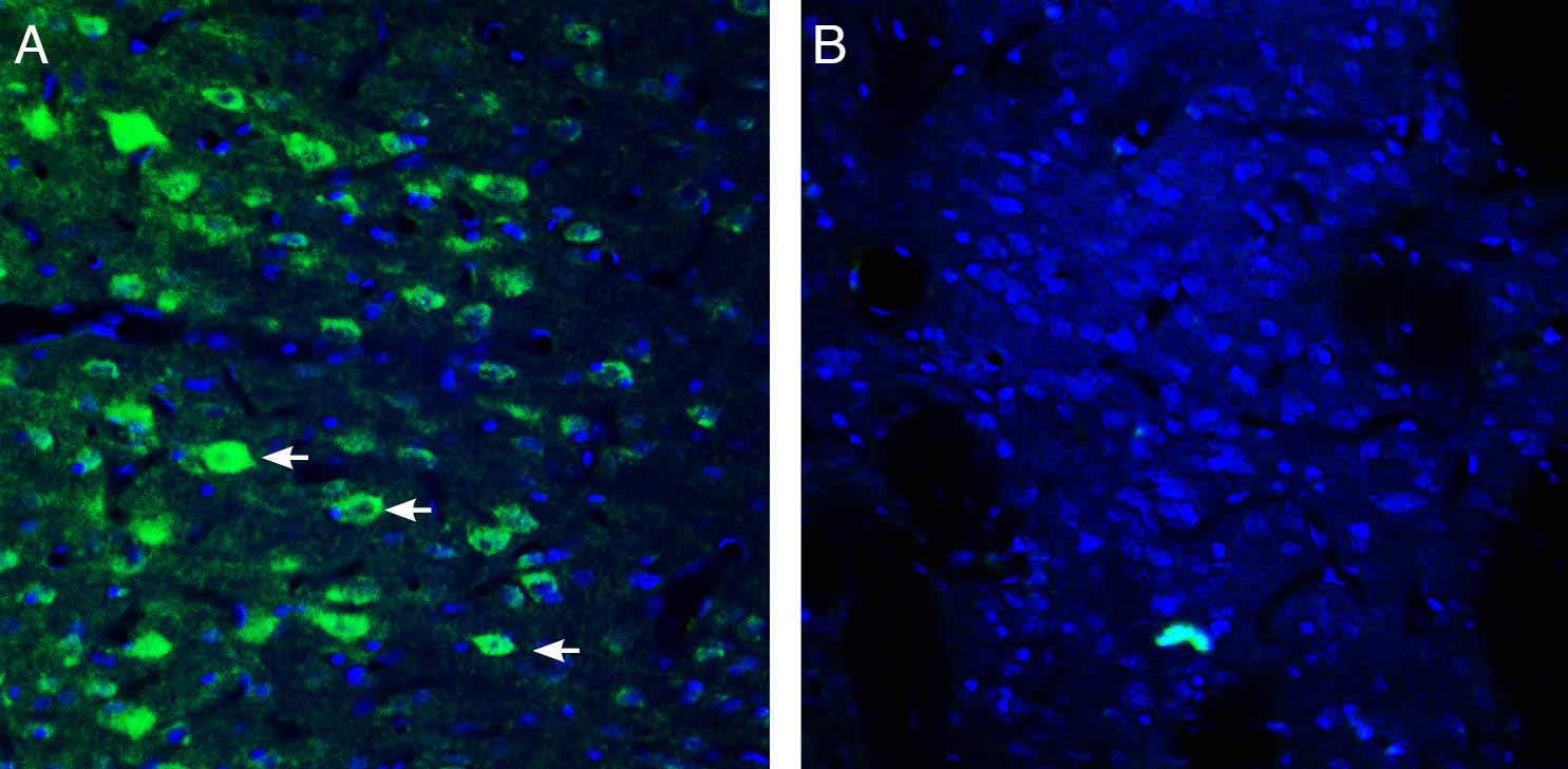Anti-GPR109A/HCAR2 (extracellular) Antibody