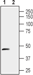 Stomatin-like Protein 1 (extracellular) Blocking Peptide
