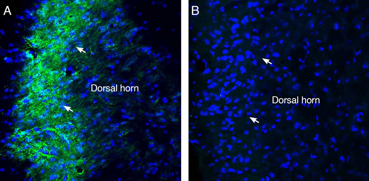 Anti-Sigma-1 Receptor Antibody