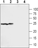 Sigma-1 Receptor Blocking Peptide