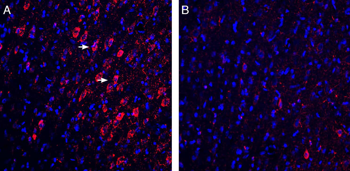Anti-GABARAP Antibody