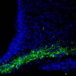 Anti-CASK Antibody