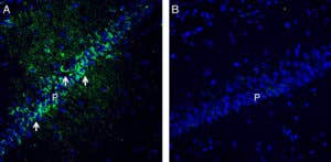 Anti-PACSIN1 Antibody