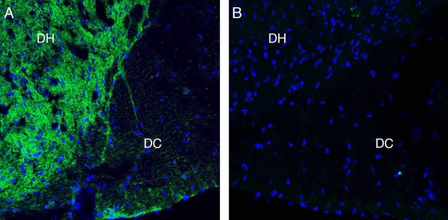 Anti-Neurofascin Antibody