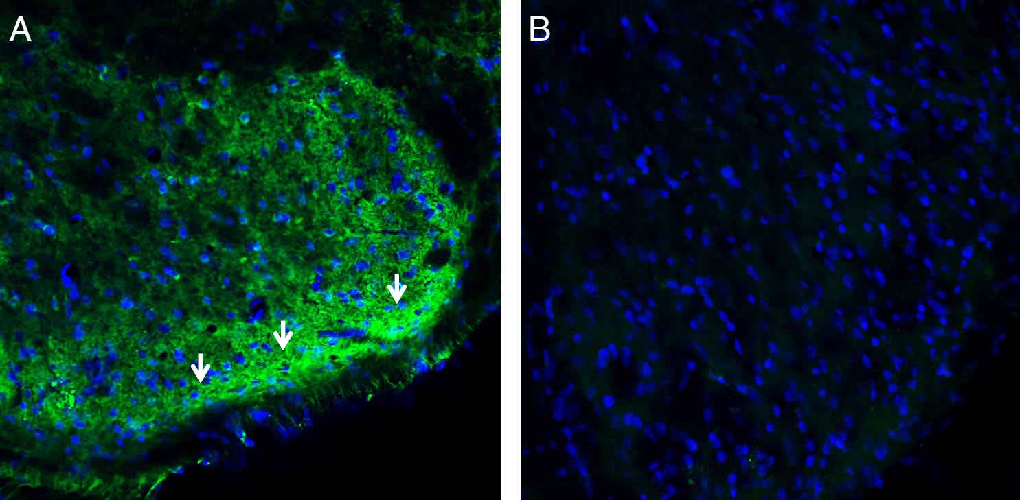 Anti-CRMP2 Antibody