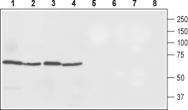 Ferroportin/SLC40A1 Blocking Peptide