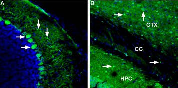 Anti-Ferroportin (SLC40A1) Antibody