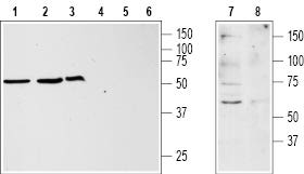 KISS1 Receptor/GPR54 (extracellular) Blocking Peptide
