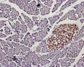 Anti-KISS1 Receptor (GPR54) (extracellular) Antibody