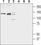 Anti-KCC1 (SLC12A4) Antibody