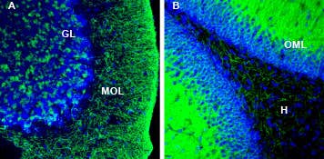 Anti-KCC2 (SLC12A5) Antibody