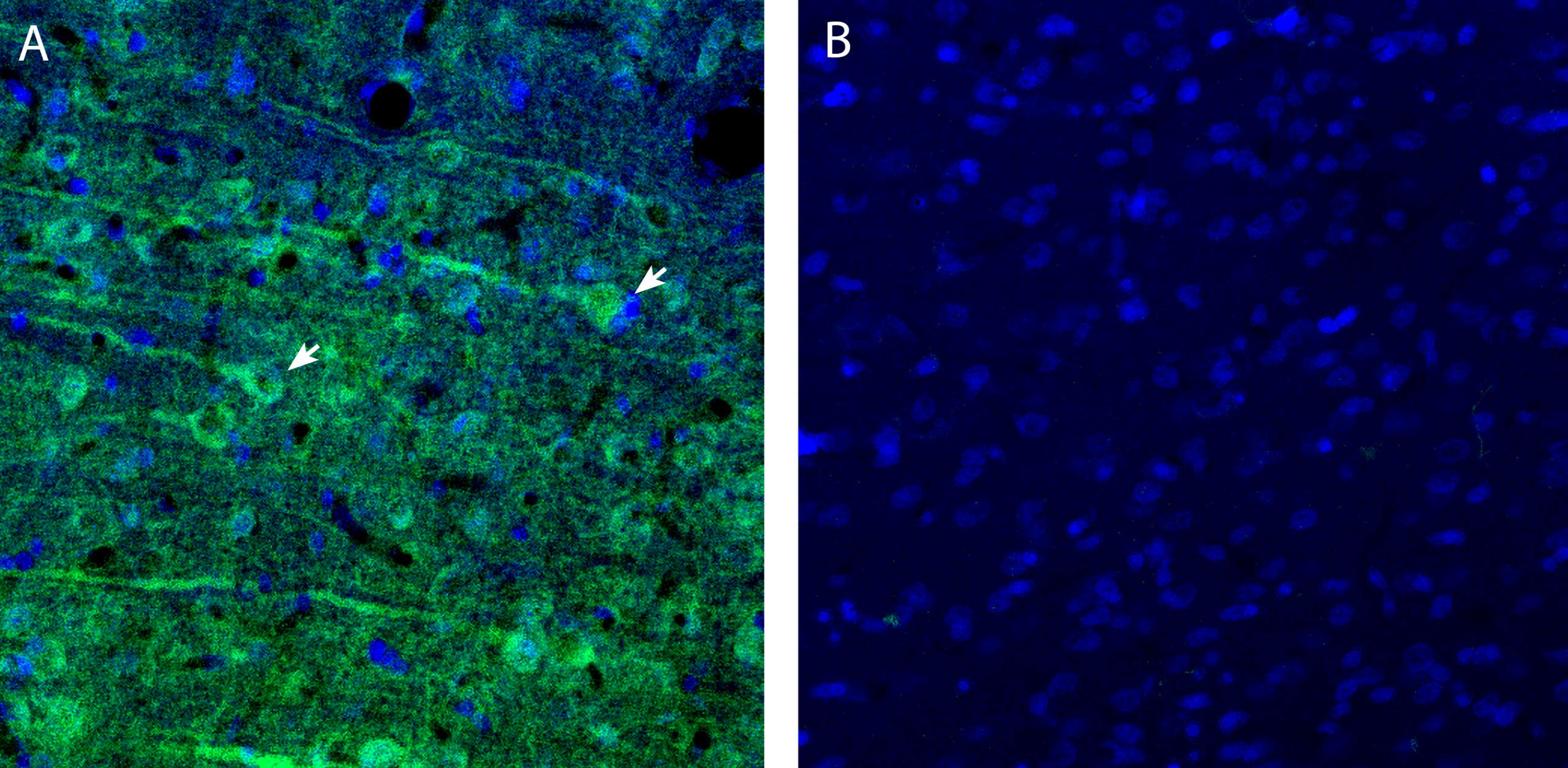 Anti-CCC9 (SLC12A8) (extracellular) Antibody