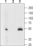 Mouse Anti-GIRK1 (K<sub>ir</sub>3.1) (extracellular) Antibody