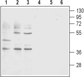 Human BLT1 (extracellular) Blocking Peptide