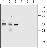 CysLTR1 (extracellular) Blocking Peptide